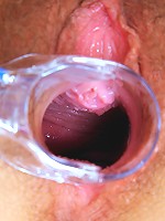 Hairy Blonde Speculums Up her Vagina in Closeup