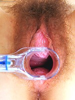 Hairy Blonde Speculums Up her Vagina in Closeup